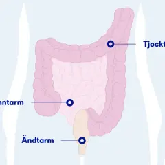 Illustration av tjocktarm, tunntarm och ändtarm. Om du känner solar plexus ont, kan det bero på problem i dessa delar av kroppen.