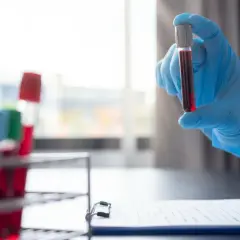 Blodprov i provrör, redo för analys. För att få korrekta resultat är det viktigt med en blodprov fastande mage.