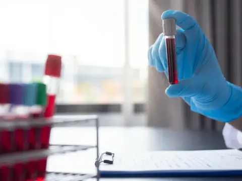 Fasta inför blodprov - Allt du behöver veta för rätt svar