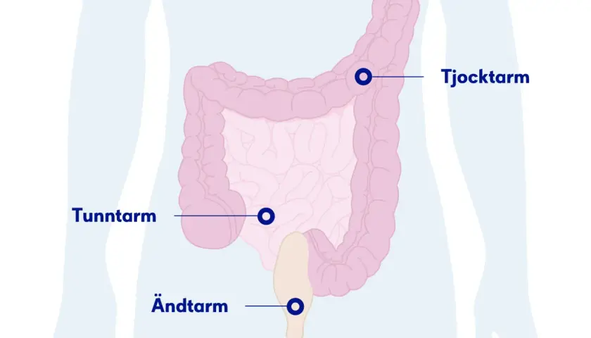 Illustration av tjocktarm, tunntarm och ändtarm. Om du känner solar plexus ont, kan det bero på problem i dessa delar av kroppen.