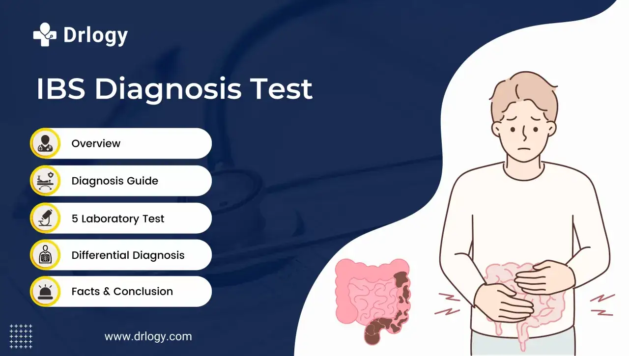 Illustration av en person med magsm&auml;rtor, en bild av tarmar och en lista &ouml;ver steg f&ouml;r IBS-diagnostik.
